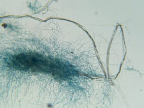 HONGOS PARA LA DEGRADACIÓN DE PLÁSTICOS