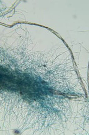 HONGOS PARA LA DEGRADACIÓN DE PLÁSTICOS