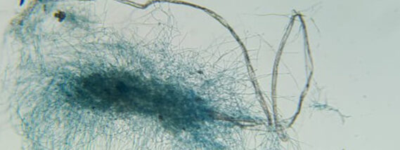 HONGOS PARA LA DEGRADACIÓN DE PLÁSTICOS