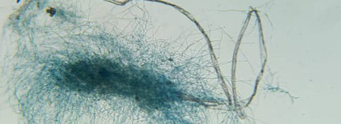 HONGOS PARA LA DEGRADACIÓN DE PLÁSTICOS