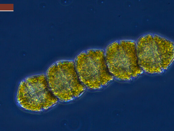 IMPACTO DE LAS MAREAS ROJAS SOBRE ECOSISTEMAS Y SALUD HUMANA